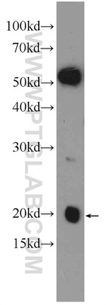 NDUFA8 Antibody in Western Blot (WB)