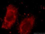 NDUFS3 Antibody in Immunocytochemistry (ICC/IF)