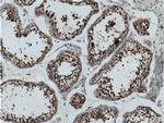 PCBP2 Antibody in Immunohistochemistry (Paraffin) (IHC (P))