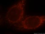 PI4K2B Antibody in Immunocytochemistry (ICC/IF)
