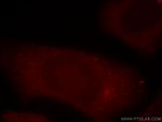 PI4K2B Antibody in Immunocytochemistry (ICC/IF)