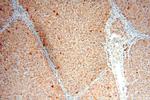 PI4K2B Antibody in Immunohistochemistry (Paraffin) (IHC (P))
