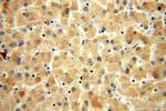 PI4K2B Antibody in Immunohistochemistry (Paraffin) (IHC (P))