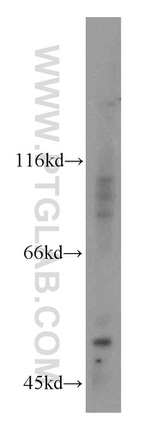 PI4K2B Antibody in Western Blot (WB)