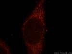 SUOX Antibody in Immunocytochemistry (ICC/IF)