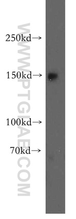 VPS8 Antibody in Western Blot (WB)
