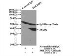 POLDIP2 Antibody in Immunoprecipitation (IP)
