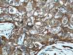 PDAP1 Antibody in Immunohistochemistry (Paraffin) (IHC (P))