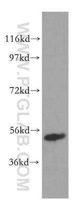 LPCAT2 Antibody in Western Blot (WB)