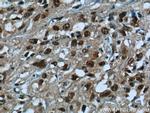 SNRPG Antibody in Immunohistochemistry (Paraffin) (IHC (P))