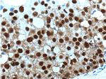 SNRPG Antibody in Immunohistochemistry (Paraffin) (IHC (P))