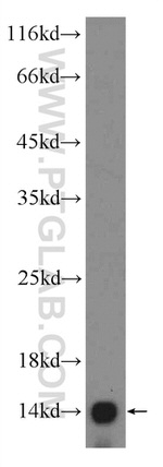 SEC61B Antibody in Western Blot (WB)