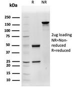 Cathepsin D (Tumor Marker) Antibody in Immunoelectrophoresis (IE)