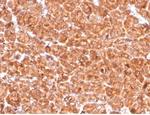 Cathepsin D (Tumor Marker) Antibody in Immunohistochemistry (Paraffin) (IHC (P))