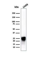 Cathepsin D (Tumor Marker) Antibody in Western Blot (WB)
