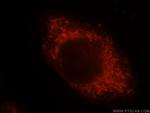 ALDH3A2 Antibody in Immunocytochemistry (ICC/IF)