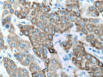 ALDH3A2 Antibody in Immunohistochemistry (Paraffin) (IHC (P))