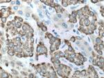 ALDH3A2 Antibody in Immunohistochemistry (Paraffin) (IHC (P))
