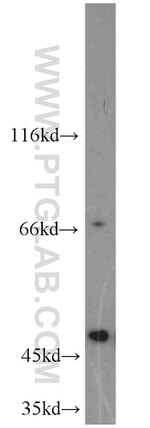 ALDH3A2 Antibody in Western Blot (WB)