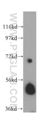 ALDH3A2 Antibody in Western Blot (WB)