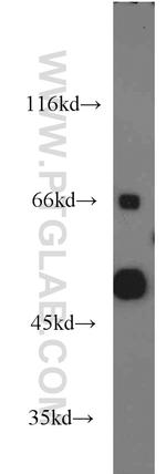 ALDH3A2 Antibody in Western Blot (WB)