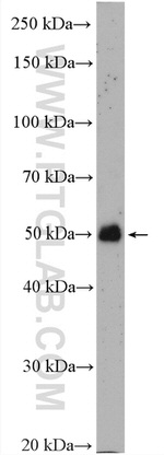 ALDH3A2 Antibody in Western Blot (WB)