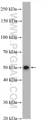 ALDH3A2 Antibody in Western Blot (WB)