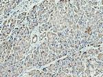 ALG2 Antibody in Immunohistochemistry (Paraffin) (IHC (P))
