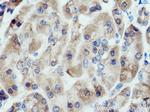 ALG2 Antibody in Immunohistochemistry (Paraffin) (IHC (P))