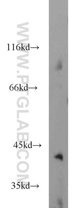 GMPPB Antibody in Western Blot (WB)