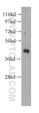 GMPPB Antibody in Western Blot (WB)