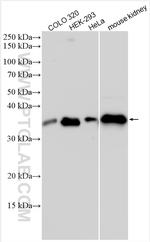 LGMN Antibody in Western Blot (WB)