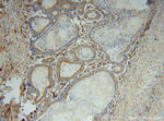 ATP6V1B2 Antibody in Immunohistochemistry (Paraffin) (IHC (P))