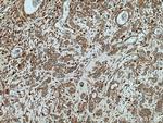 ATP6V1B2 Antibody in Immunohistochemistry (Paraffin) (IHC (P))