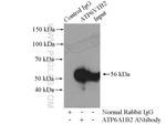 ATP6V1B2 Antibody in Immunoprecipitation (IP)
