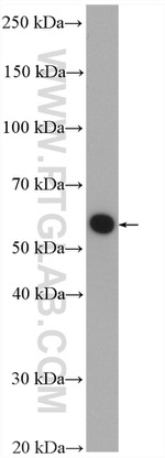 ATP6V1B2 Antibody in Western Blot (WB)