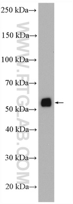 ATP6V1B2 Antibody in Western Blot (WB)