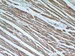 INPP5K Antibody in Immunohistochemistry (Paraffin) (IHC (P))