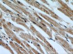 INPP5K Antibody in Immunohistochemistry (Paraffin) (IHC (P))