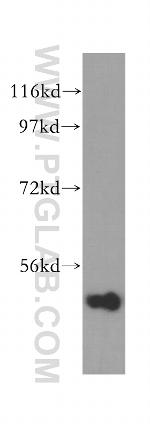 INPP5K Antibody in Western Blot (WB)