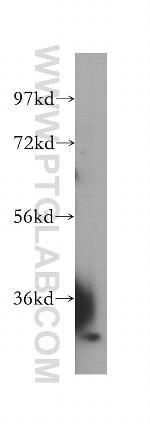DHDDS Antibody in Western Blot (WB)