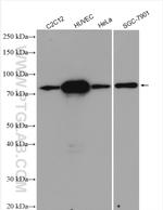 TGM2 Antibody in Western Blot (WB)