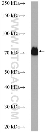 TGM2 Antibody in Western Blot (WB)