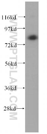 TGM2 Antibody in Western Blot (WB)