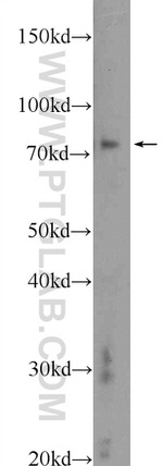 TGM2 Antibody in Western Blot (WB)