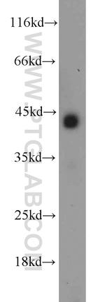 IL10RB Antibody in Western Blot (WB)