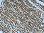 MGAT1 Antibody in Immunohistochemistry (Paraffin) (IHC (P))