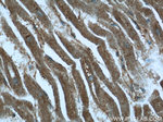 MGAT1 Antibody in Immunohistochemistry (Paraffin) (IHC (P))