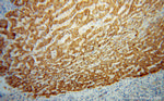MGAT1 Antibody in Immunohistochemistry (Paraffin) (IHC (P))
