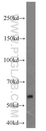 MGAT1 Antibody in Western Blot (WB)